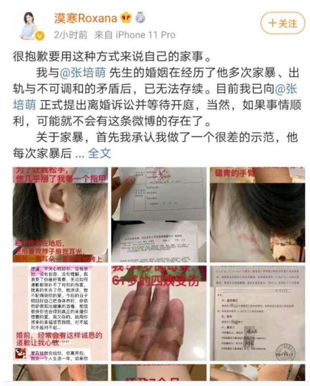 張培萌妻子稱只想要女兒撫養(yǎng)權1.jpg