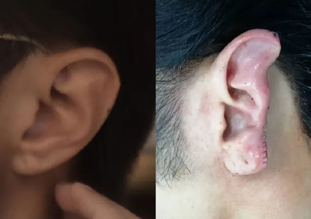 上海咬耳案犯罪嫌疑人落網(wǎng)1.jpg