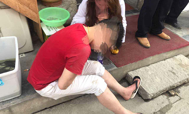 把普通人當搶劫犯打了需要承擔什么法律責任？